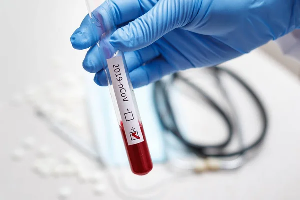 Blood test tube in doctor hand, Mers-CoV Coronavirus test Positive label in hospital blood test tube for analysis. 2019-nCoV virus COVID-19 infection originating in Wuhan, China
