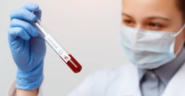 Doktorun elinde kan testi tüpü, analiz için hastanede Mers-Cov Coronavirus etiketi pozitif çıktı. 2019-ncov virüsü Covid-19 enfeksiyonu Çin, Wuhan 'dan kaynaklanıyor.