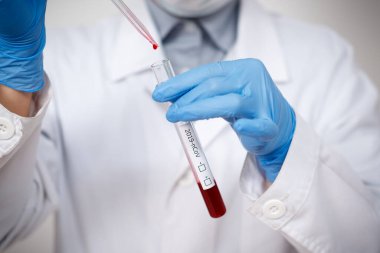 Epidemiyoloji uzmanı koronavirüs için kan testi yaptırıyor. Salgın Coronavirus 2019-ncov, Covid-19