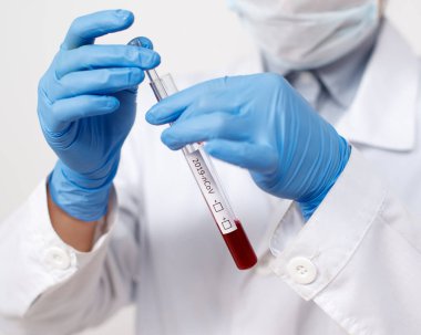 Epidemiyoloji uzmanı koronavirüs için kan testi yaptırıyor. Salgın Coronavirus 2019-ncov, Covid-19