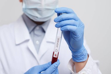 Doktorun elinde kan testi tüpü, analiz için hastanede Mers-Cov Coronavirus etiketi pozitif çıktı. 2019-ncov virüsü Covid-19 enfeksiyonu Çin, Wuhan 'dan kaynaklanıyor.
