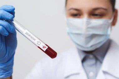 Coronavirus COVID 19 nCov Salgını. Corona Virüs Kan Tüp Hastası 'ndan tıbbi ya da bilimsel olarak tutuluyor. Korona virüsü Avrupa, İtalya, Wuhan, Çin. Salgın ve Salgın Enfeksiyon