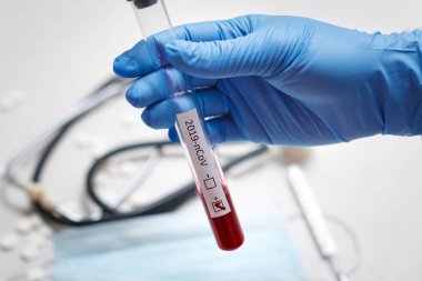Doktorun elinde kan testi tüpü, analiz için hastanede Mers-Cov Coronavirus etiketi pozitif çıktı. 2019-ncov virüsü Covid-19 enfeksiyonu Çin, Wuhan 'dan kaynaklanıyor.