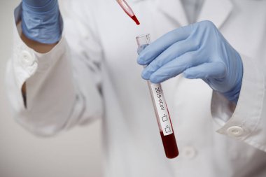 Coronavirus Covid 19, Coronavirus Covid 19 araştırma laboratuarı Coronavirus Covid-19 aşı araştırma laboratuarındaki doktor biyolojik tehlike koruma giysisinin örnek tüpünden enfekte olmuş kan örneği.