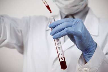 Coronavirus Covid 19, Coronavirus Covid 19 araştırma laboratuarı Coronavirus Covid-19 aşı araştırma laboratuarındaki doktor biyolojik tehlike koruma giysisinin örnek tüpünden enfekte olmuş kan örneği.