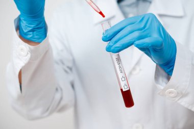 Coronavirus Covid 19, Coronavirus Covid 19 araştırma laboratuarı Coronavirus Covid-19 aşı araştırma laboratuarındaki doktor biyolojik tehlike koruma giysisinin örnek tüpünden enfekte olmuş kan örneği.