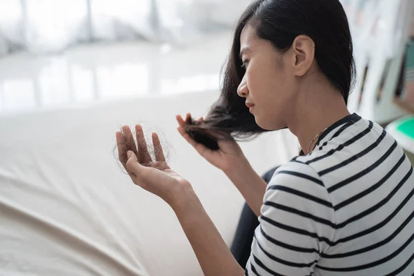 Woman damage hair loss — Stock Photo, Image