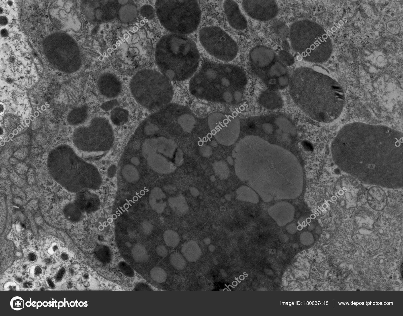 Lysosome Electron Micrograph