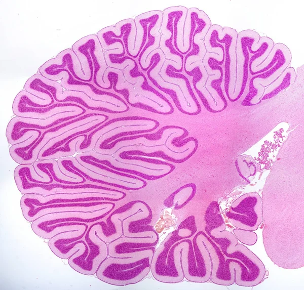 Cerebellum. Secção sagital — Fotografia de Stock