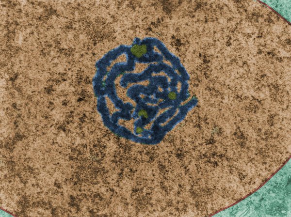 Ядро. Фальшивый цвет TEM
