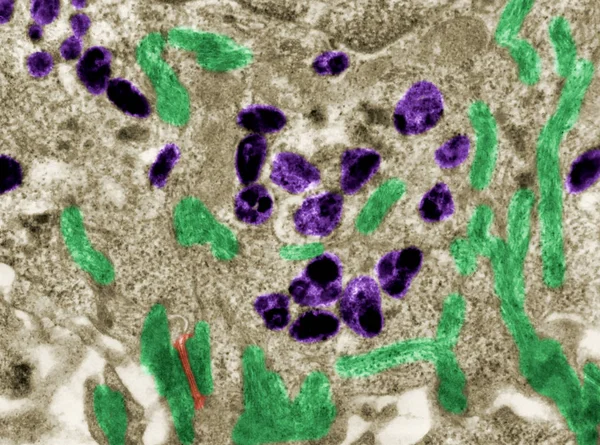 皮膚細胞内のメラニン顆粒。偽色 Tem — ストック写真