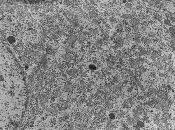 Neuron. Organelli cellulari, TEM — Foto Stock