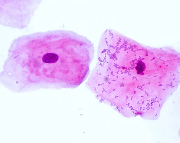 Cellule epiteliali squamose — Foto Stock