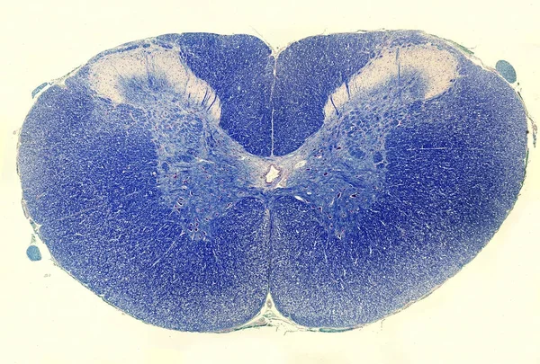 Rückenmark. luxol schnell blauer Fleck — Stockfoto