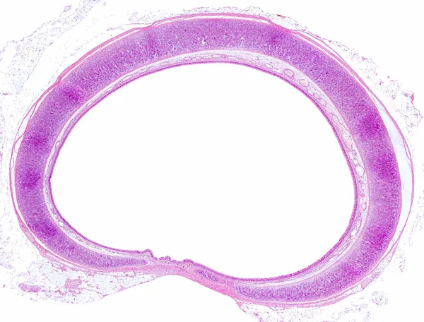 Traqueia — Fotografia de Stock