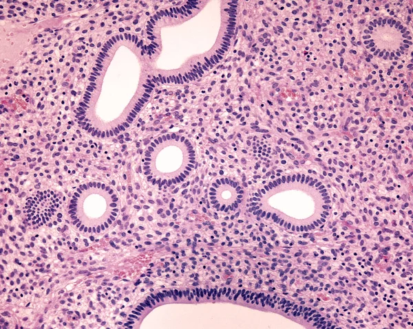 Endometrium. Proliferační fáze — Stock fotografie