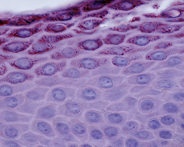 Epidermis — Foto de Stock