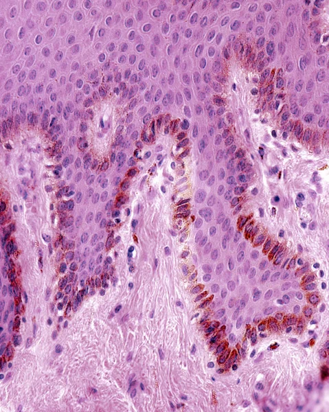 Melanosit. Epidermis — Stok fotoğraf