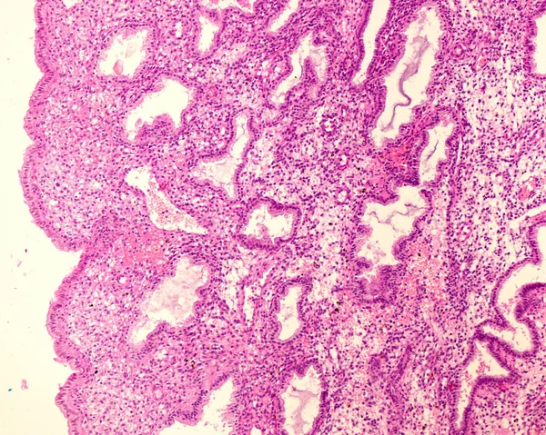 Endometrium. Sekreční fáze — Stock fotografie