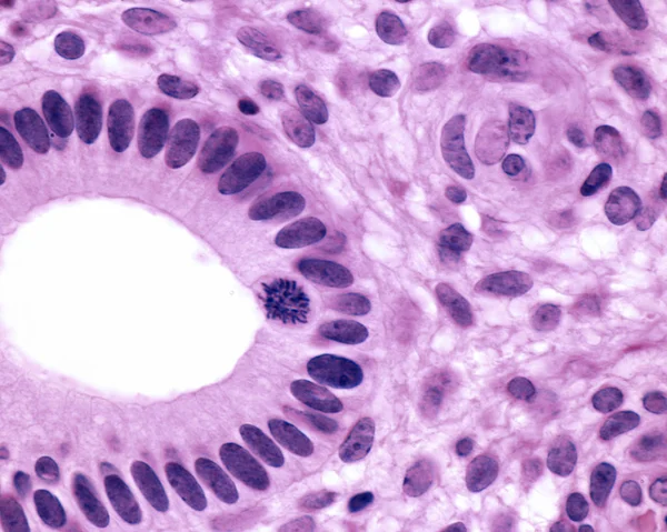 Glandula uterina — Fotografia de Stock