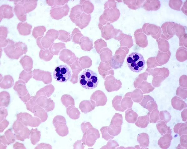 Neutrofilos. Mancha de sangre —  Fotos de Stock