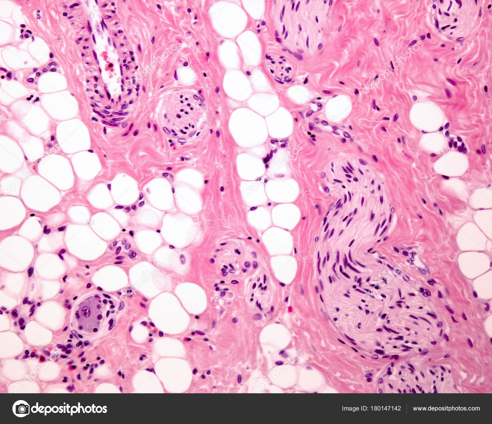 Tecido Adiposo Fotos Imagens De Jlcalvo Ucm Es | My XXX Hot Girl