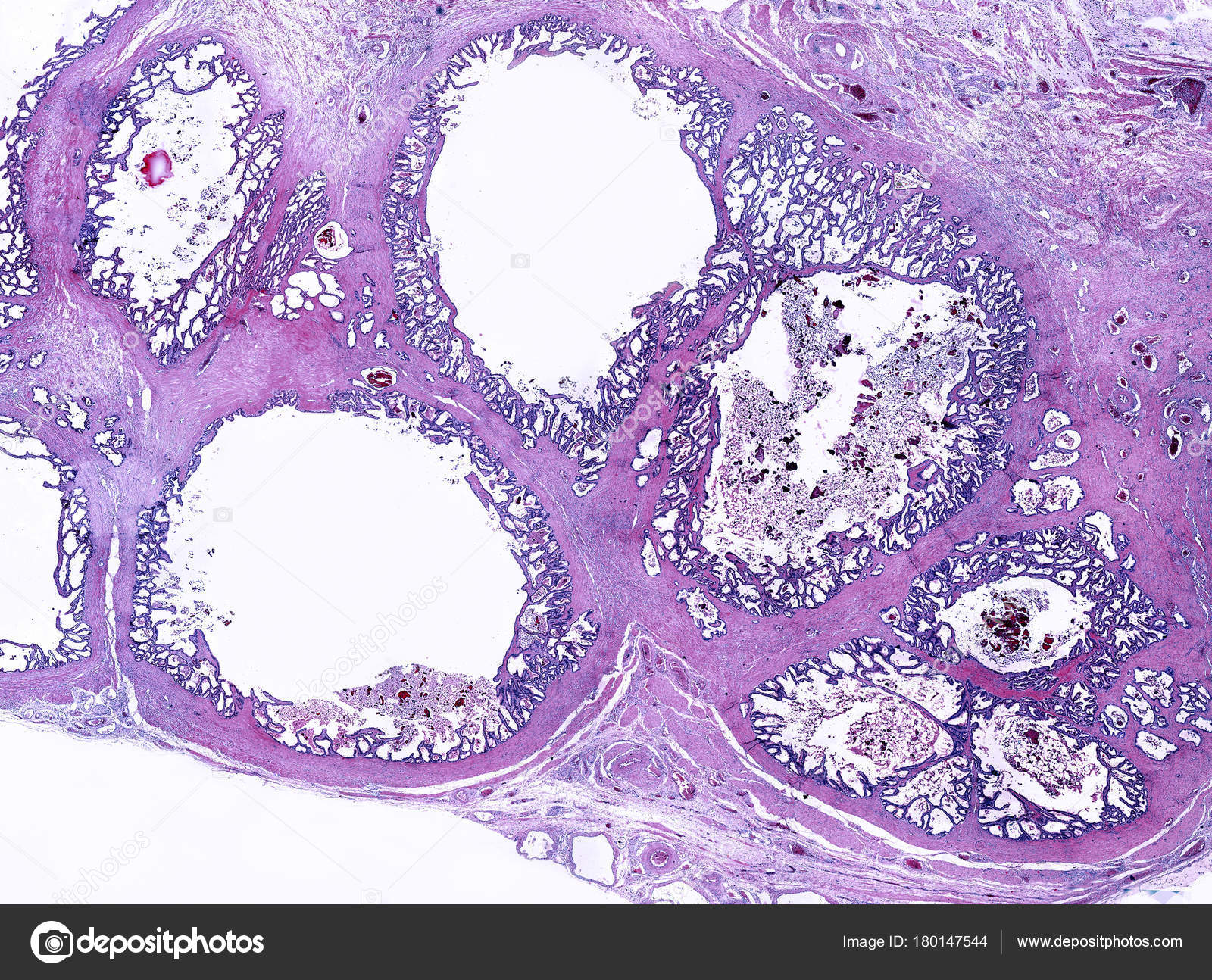 Imágenes vesicula seminal Vesícula seminal — Foto de