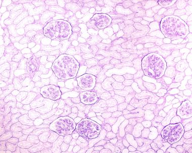 Kidney. PAS