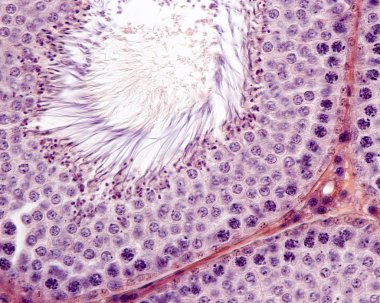 spermatogenez