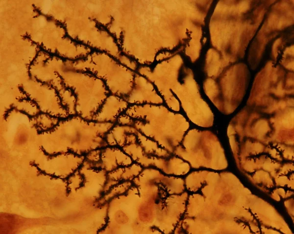 Purkinje neuron. Dendritikus tüskék — Stock Fotó