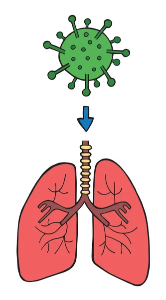 Рука Намальована Векторна Ілюстрація Вірусу Корони Ковід Вхід Вірусу Легені — стоковий вектор