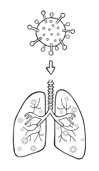 Illustrazione Vettoriale Disegnata Mano Del Virus Wuhan Corona Covid Ingresso — Vettoriale Stock