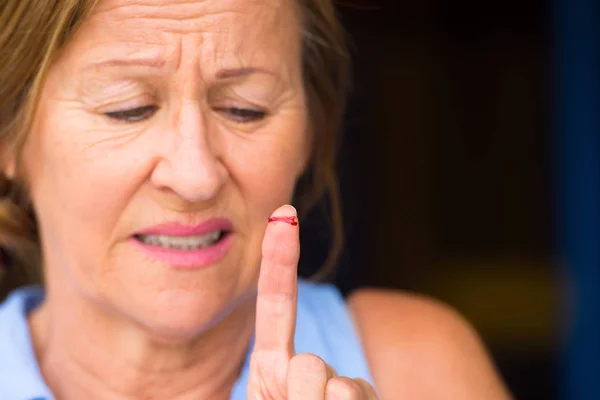 Stressed Woman bloody cut finger wound — Stock Photo, Image