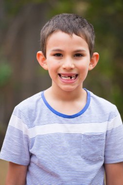 Portre çocuk eksik süt diş açık