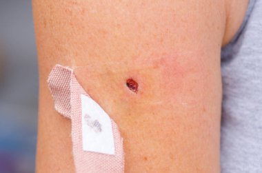 Cilt üzerinde yara kanlı grev kırıcı ve grubu yardım