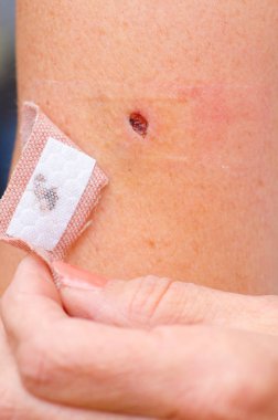 Kanlı grev kırıcı yara ve grubu yardım cilt üzerinde kapatın