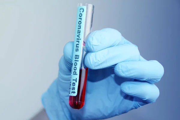 Laboratorio médico probeta con sangre en la mano de un médico virólogo, concepto de virología, epidemia, propagación del virus CoV — Foto de Stock