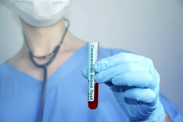 Медична лабораторна пробірка з кров'ю в руці лікаря-вірусолога, концепція вірусології, епідемії, поширення вірусу CoV — стокове фото