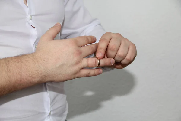 Junger Mann Weißen Hemd Zieht Sich Ausdrucksvoll Einen Goldenen Ehering — Stockfoto