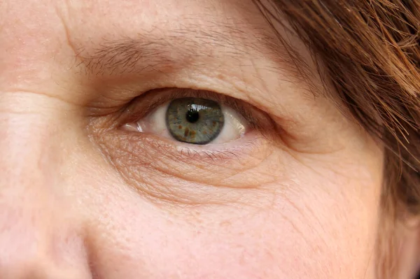 老年妇女脸上有褐色斑点的绿色眼睛 眼睑上有小皱纹 与年龄有关的人类皮肤变化概念 — 图库照片