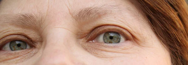 一个眼睑上有皱纹的老年妇女的眼睛 部分面部特写 与年龄有关的人类皮肤变化的概念 — 图库照片