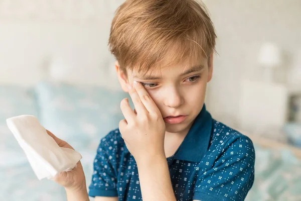 Caucasian Boy Experiences Discomfort His Eye Manifestation Allergic Reaction Redness — Stock Photo, Image