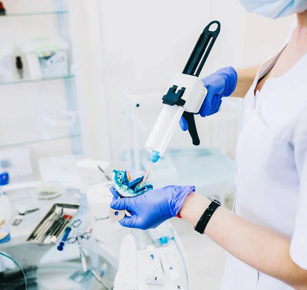 teeth impressions, dental prosthetic, dentist in the hands holds a model of jaws