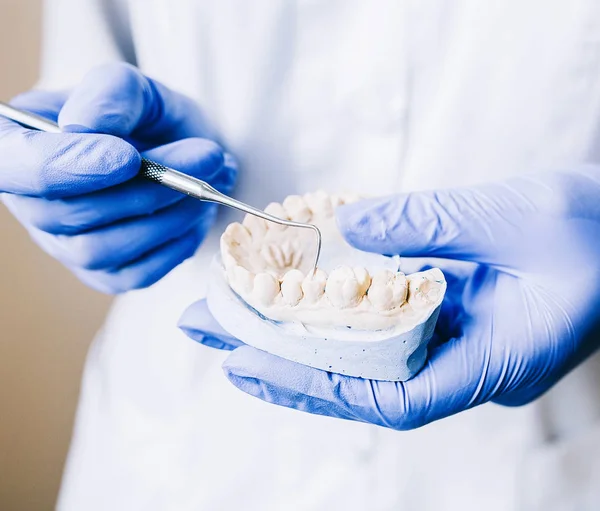 Dentist Holds Dental Model His Hands — Stock Photo, Image