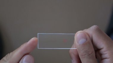 Kan şekeri testi (Glikoz normal seviyesi) evdeki tıbbi geçmişinizde. Fütürist teknoloji. veri hologramı sağlıklı konsept.