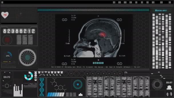 Skanowanie Mózgu Lub Prześwietlenie Hologramem Medycznym Laboratorium Tła Nauki Futurystyczna — Wideo stockowe