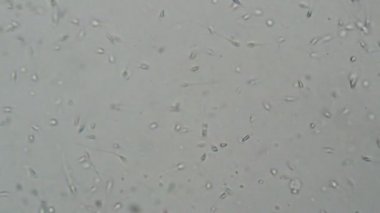 Mikroskop altında insan spermi. Laboratuvarda test ediliyor 
