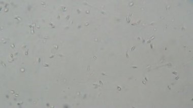 Mikroskop altında insan spermi. Laboratuvarda test ediliyor 