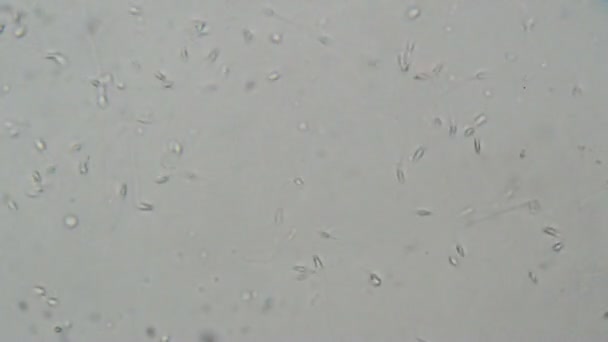 Spermatozoïdes Humains Microscope Essais Laboratoire — Video