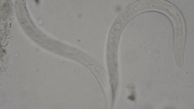 Strongyloides stercoralis mikroskop altında insan dışkısı. laboratuarda test ediliyor